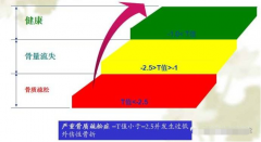 超声骨密度仪可以轻松的告诉你骨密度正常值是多少从而判断骨质量的一个重要