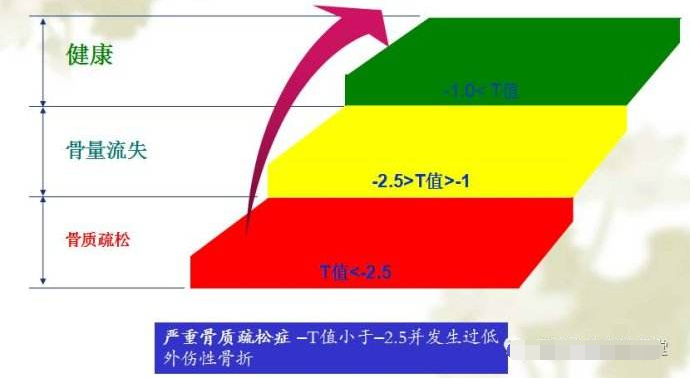 超声骨密度仪可以轻松的告诉你骨密度正常值是多少从而判断骨质量的一个重要标志