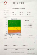 超声骨密度仪厂家阐述工程师在检测骨密度不慎说出了骨密度测量报告的秘密