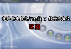 购买骨密度常识须知超声骨密度仪与双能 x 线骨密度仪的本质区别