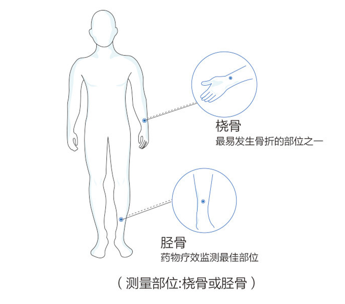 骨密度分析仪厂家分享人民群众骨密度检测前需要注意什么？