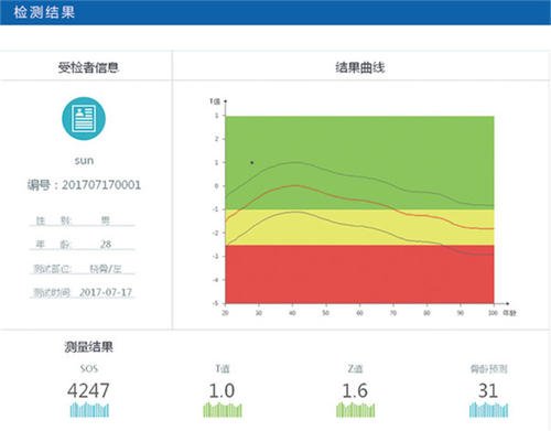 骨密度分析仪厂家简述定期检查骨密度值有什么好处(图1)