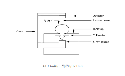 超声波【骨密度仪】器针对人体骨密度检测，你需要做吗？