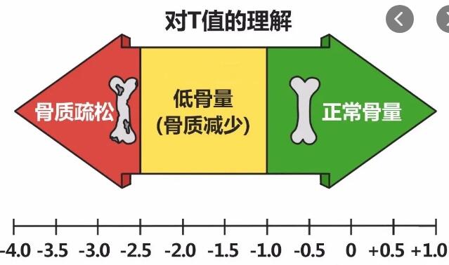 山东国康骨密度仪厂家研发的骨密度的测量方式