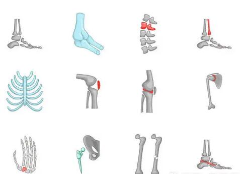 超声骨密度检测仪厂家提示你知道哪些不良习惯会损伤人体骨骼吗？