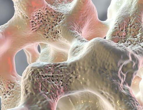 5月关注超声骨密度仪品牌国康提示骨骼不健康对人体的影响