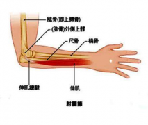 年轻小伙掰手腕就骨折了？便携式超声骨密度仪读懂骨质疏松6种迹象